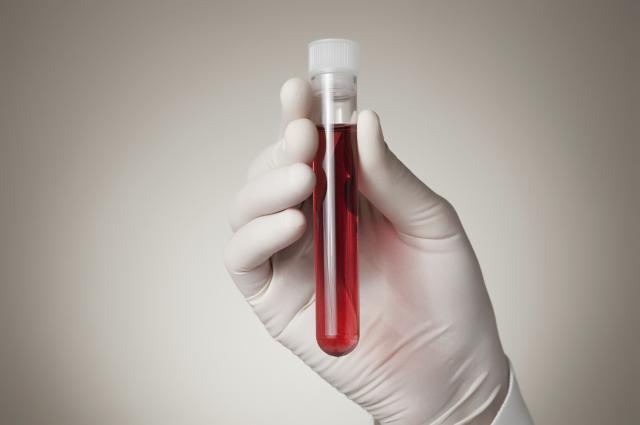 Testovi krvi æe pokazivati da li su nam potrebni antibiotici